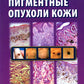 Пигментные опухоли кожи