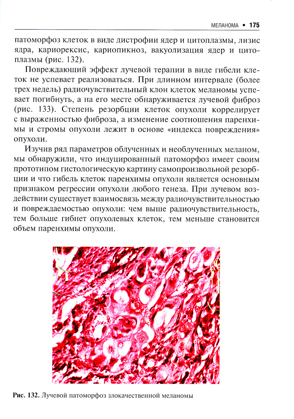 Пигментные опухоли кожи