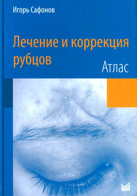 Лечение и коррекция рубцов. Atlas