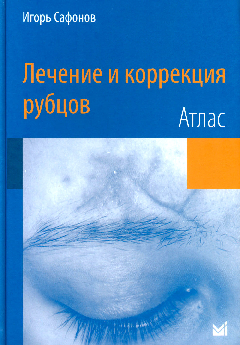 Лечение и коррекция рубцов. Atlas
