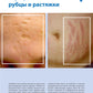 Лечение и коррекция рубцов. Atlas