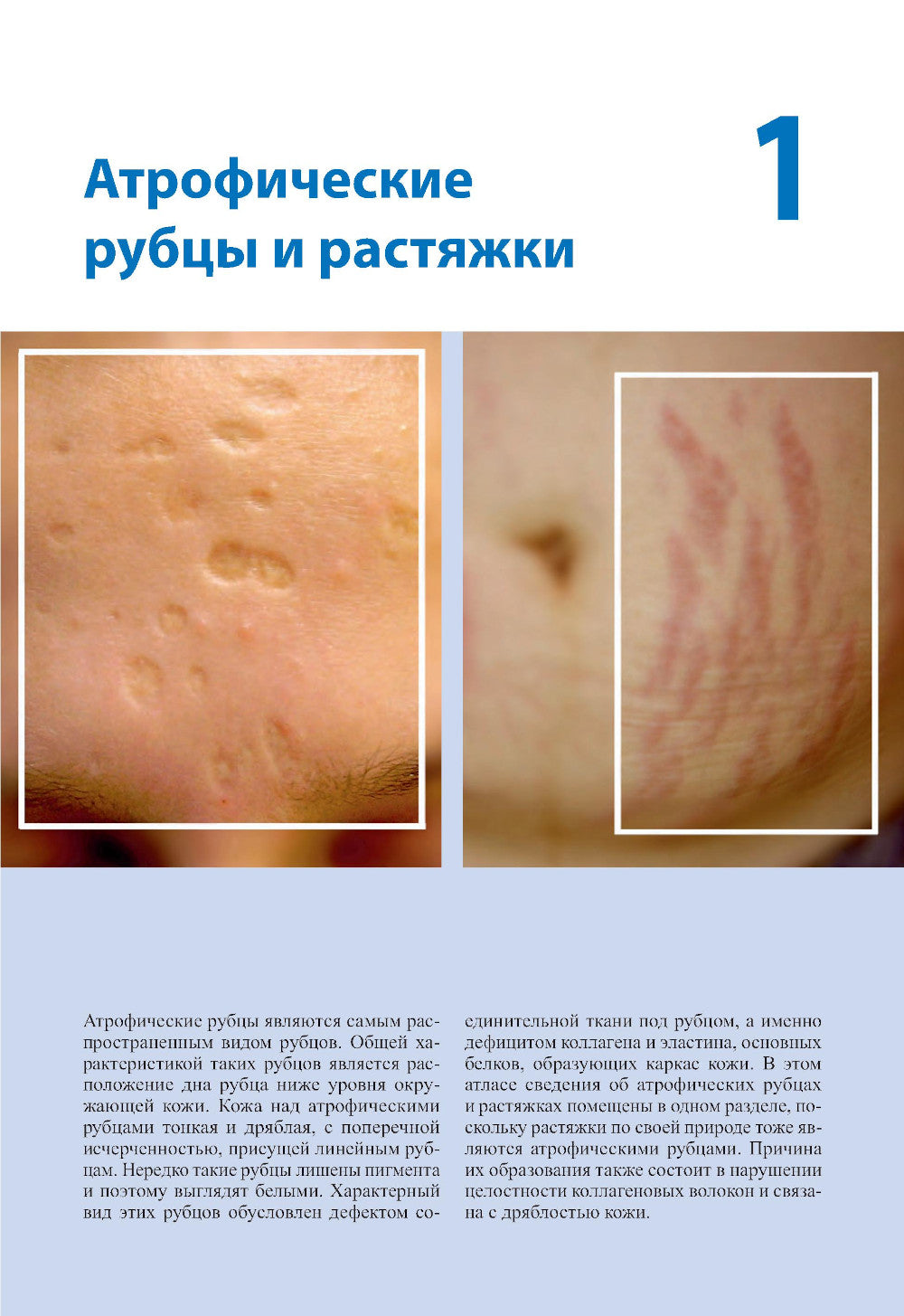 Лечение и коррекция рубцов. Atlas