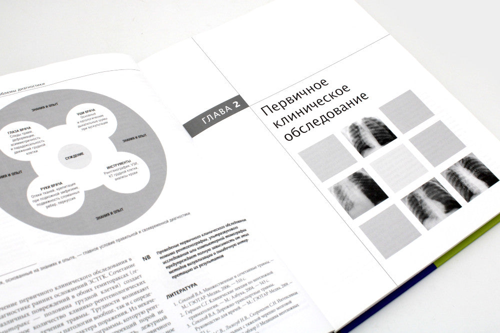 Закрытая травма грудной клетки: проблемы диагностики