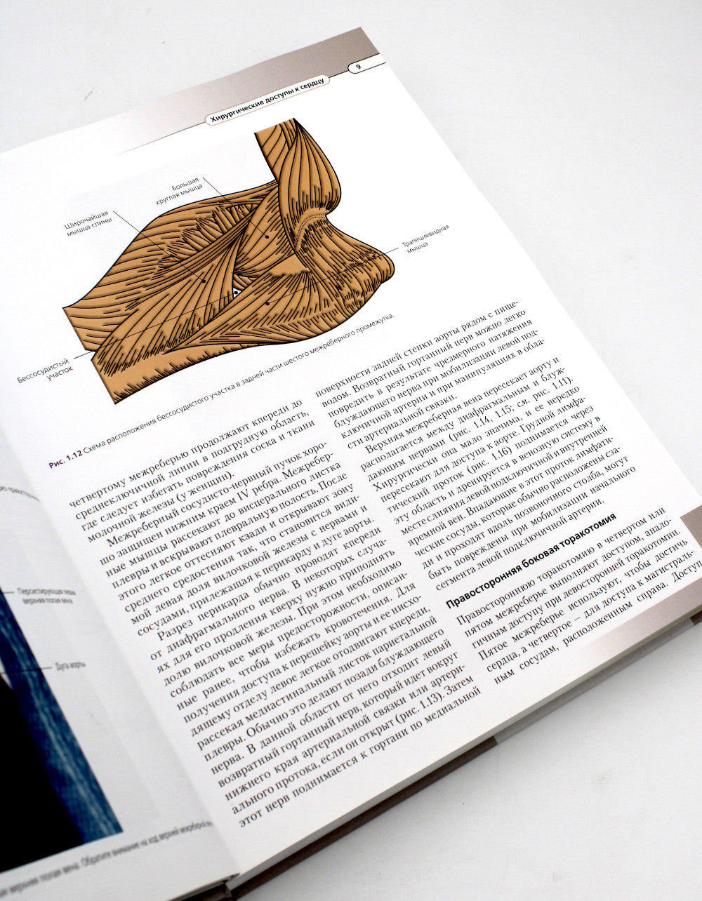 Хирургическая анатомия сердца по Уилкоксу