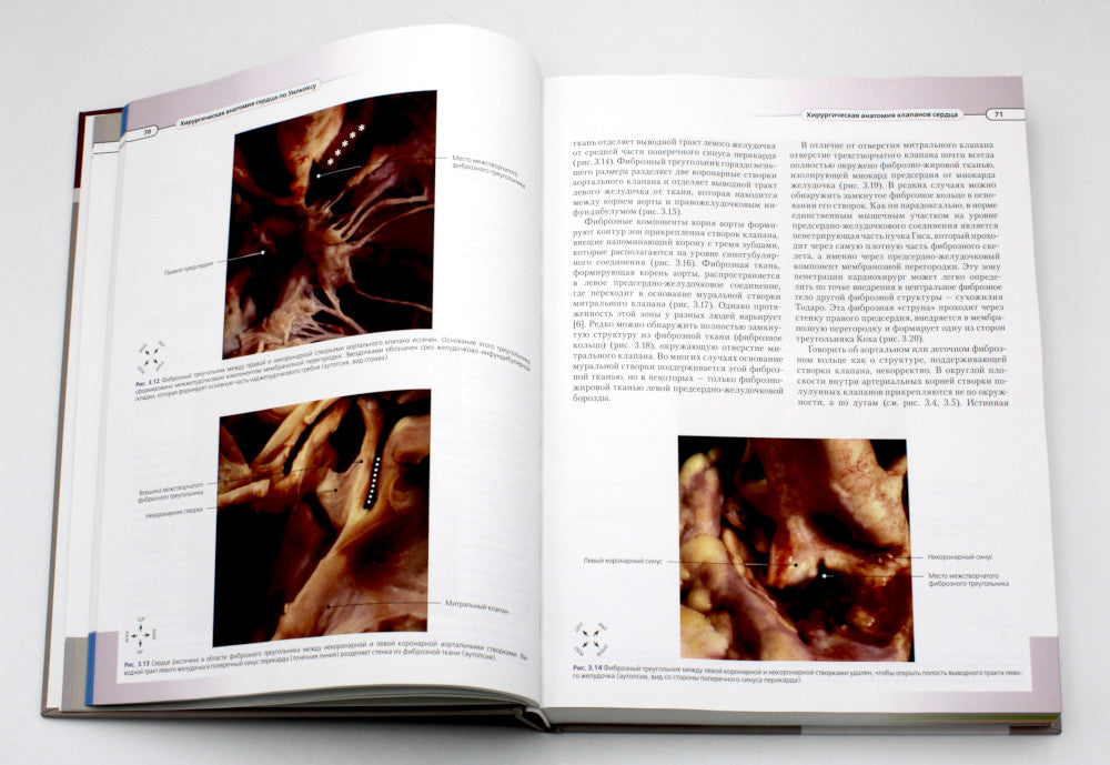 Хирургическая анатомия сердца по Уилкоксу