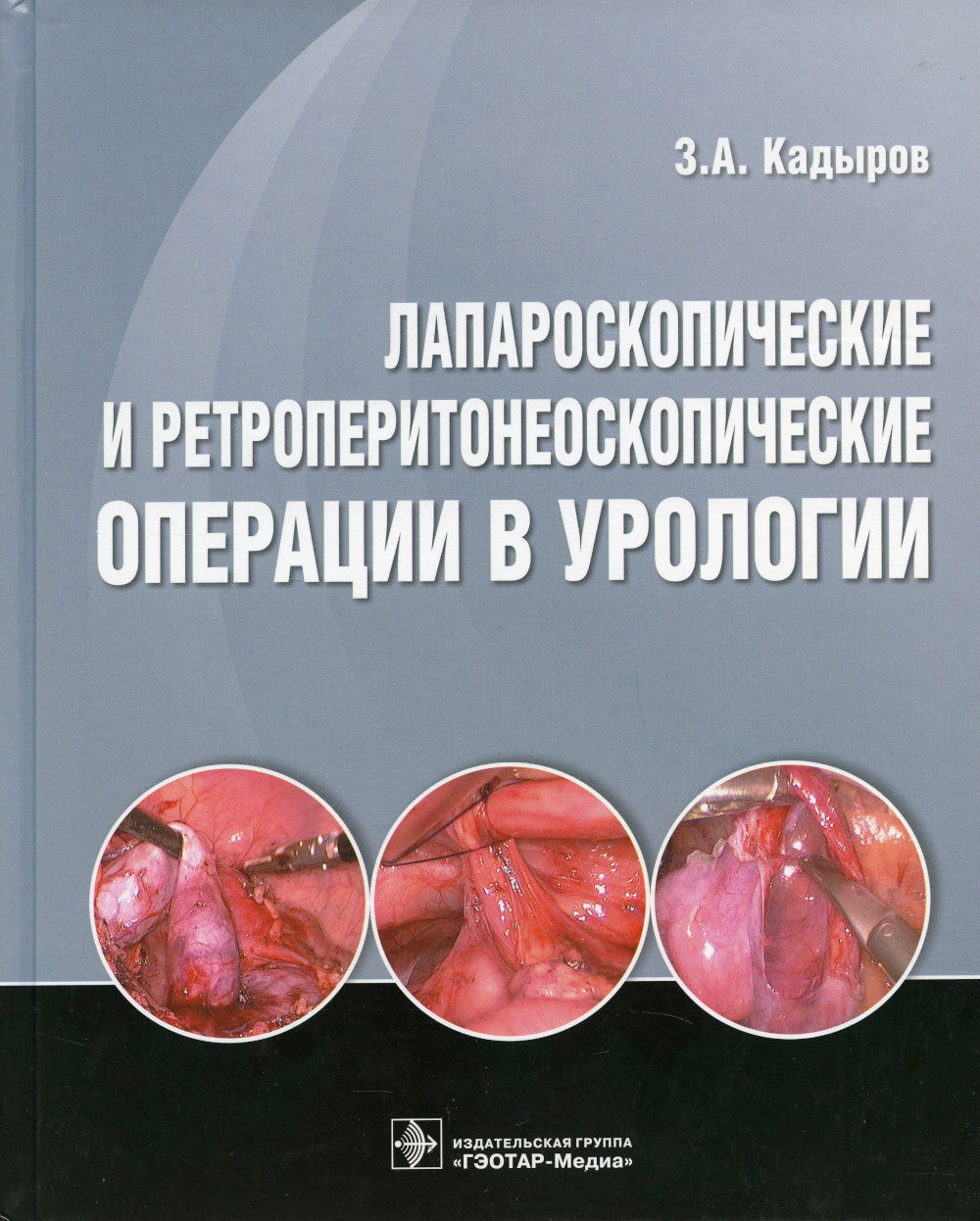 Лапароскопические и ретроперитонеоскопические операции в урологии