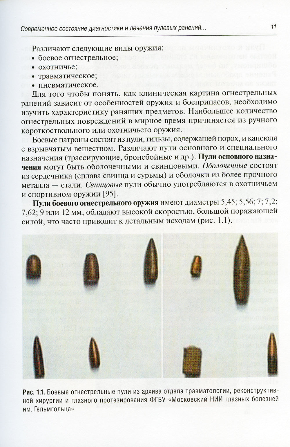 Пулевые ранения глаз и орбиты в мирное время