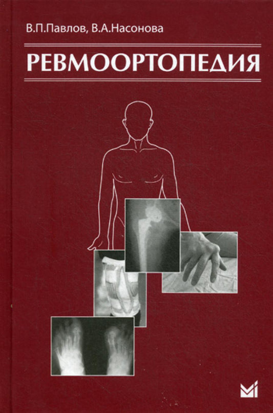 Ревмоортопедия. 3-е изд