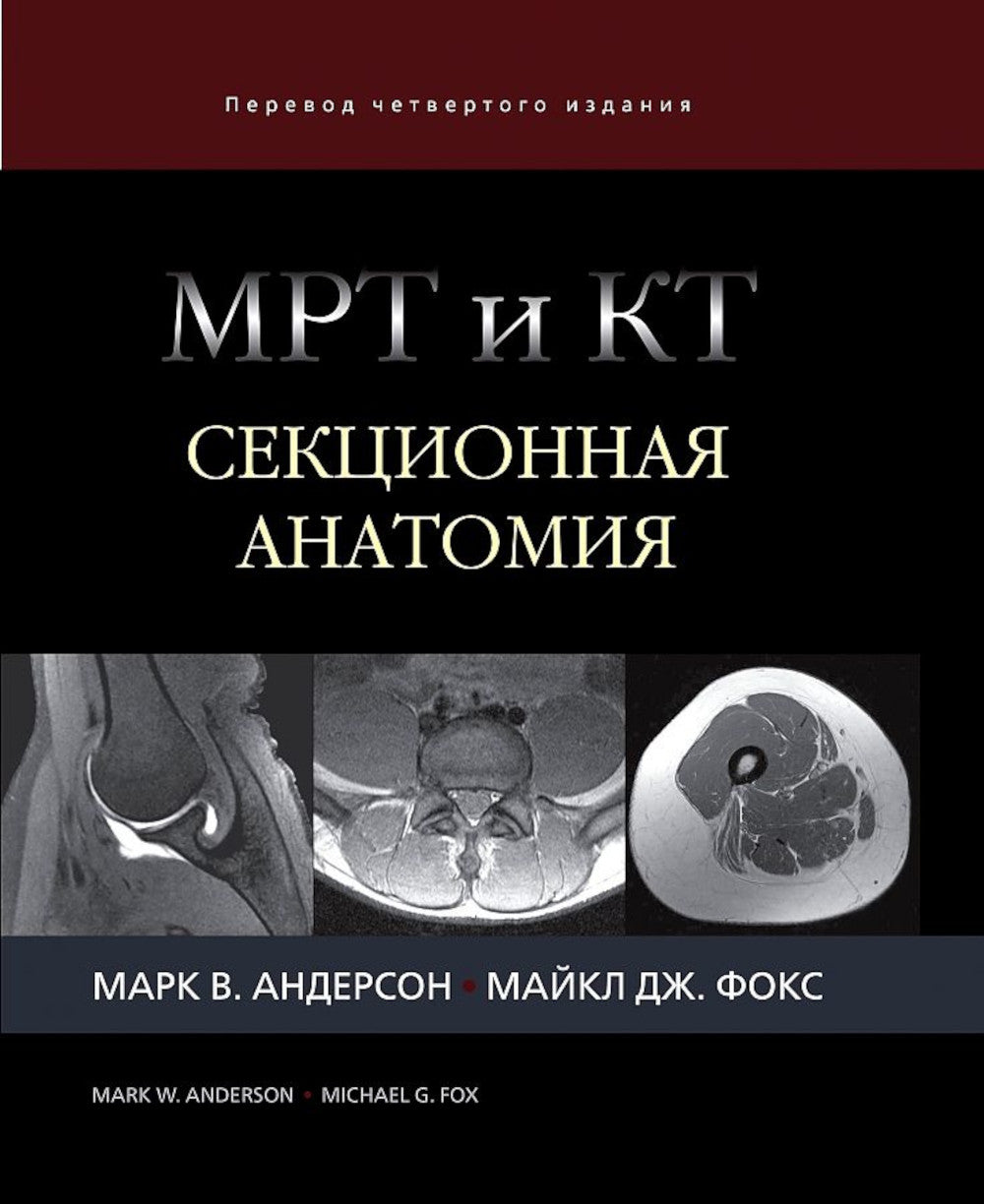 МРТ и КТ. Секционная анатомия