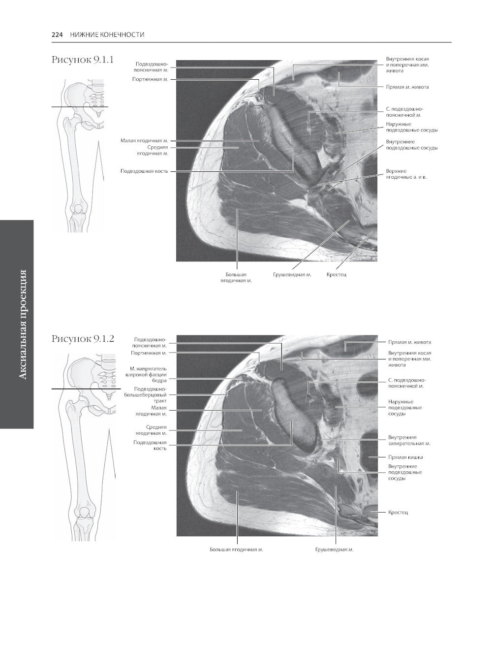 МРТ и КТ. Секционная анатомия