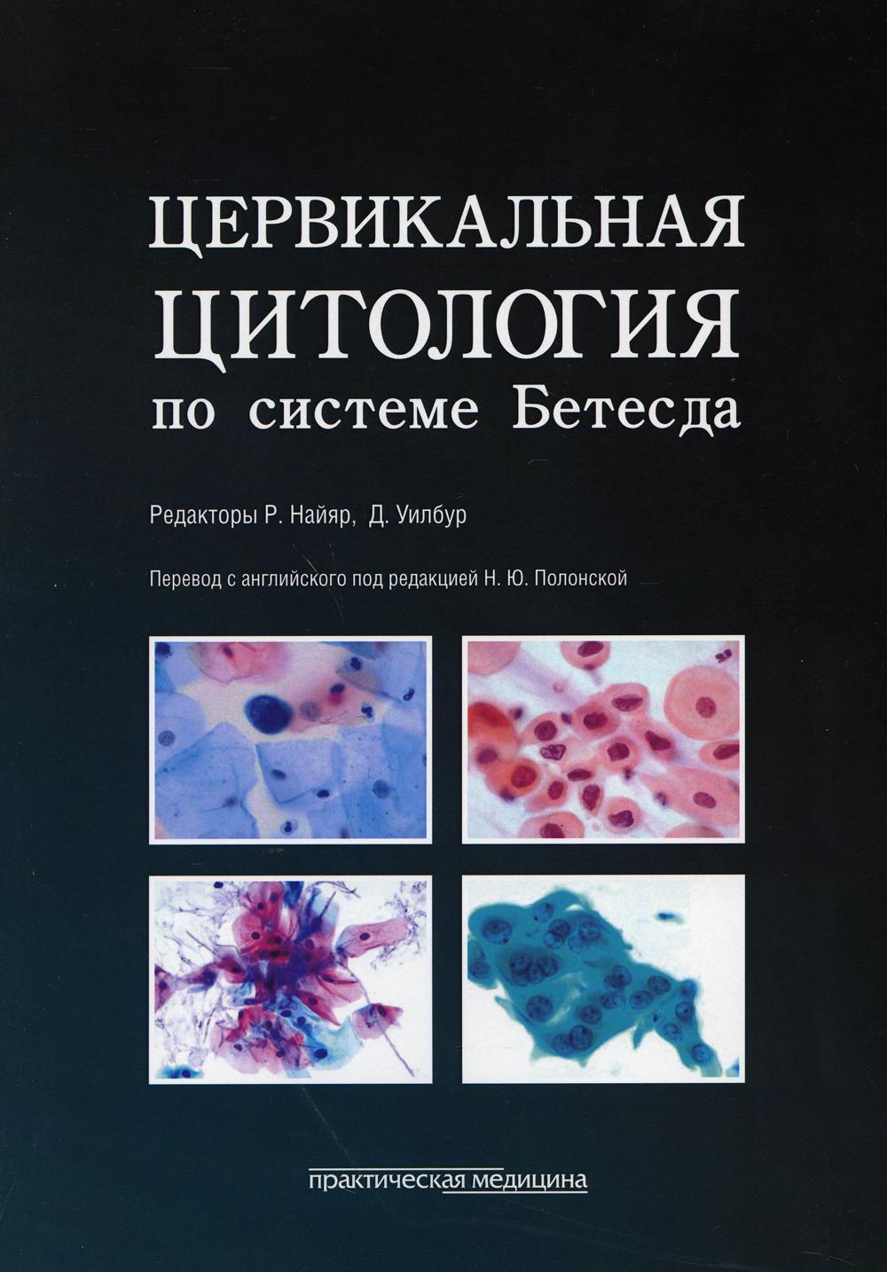 Цервикальная цитология по системе Бетесда. Терминология, критерии и пояснения