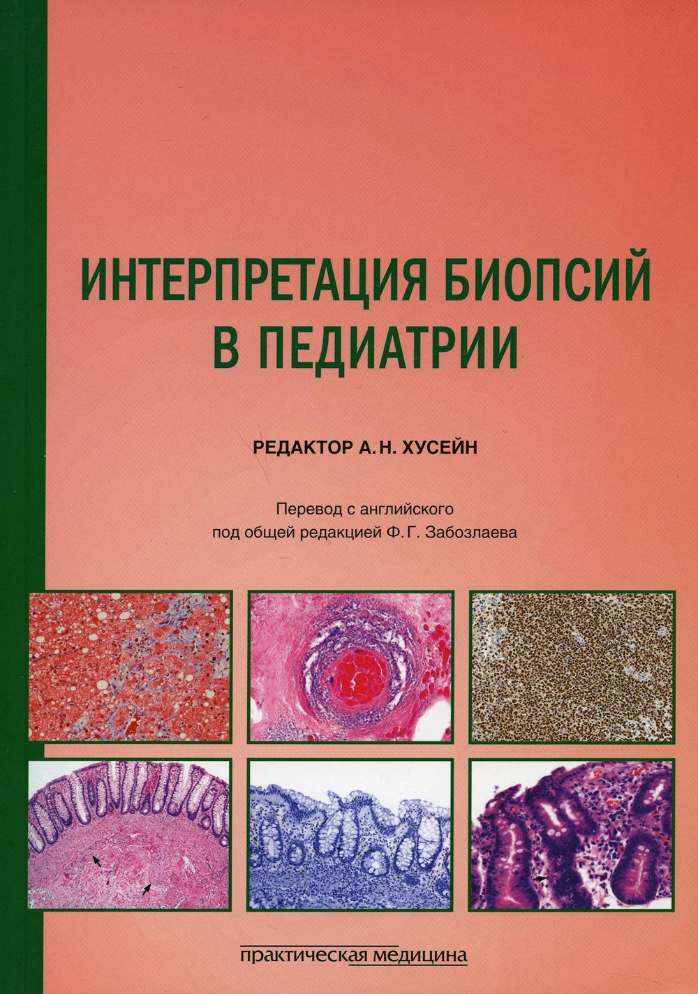 Интерпретация биопсии в педиатрии