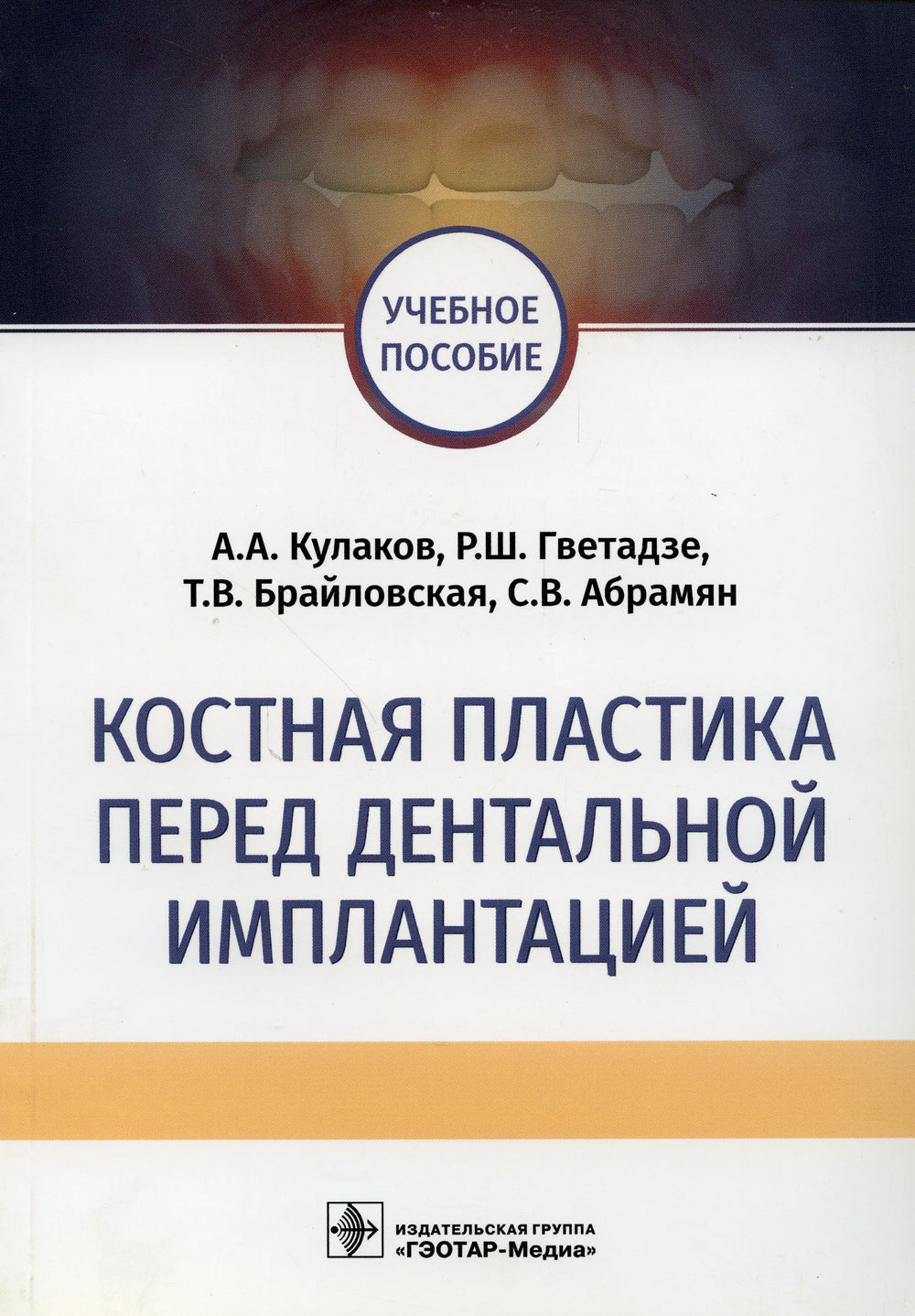 Костная пластика перед дентальной имплантацией: Учебное пособие