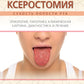 Ксеростомия (сухость полости рта). Этиология, патогенез, клиническая картина, диагностика и лечение