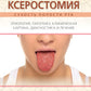 Ксеростомия (сухость полости рта). Этиология, патогенез, клиническая картина, диагностика и лечение