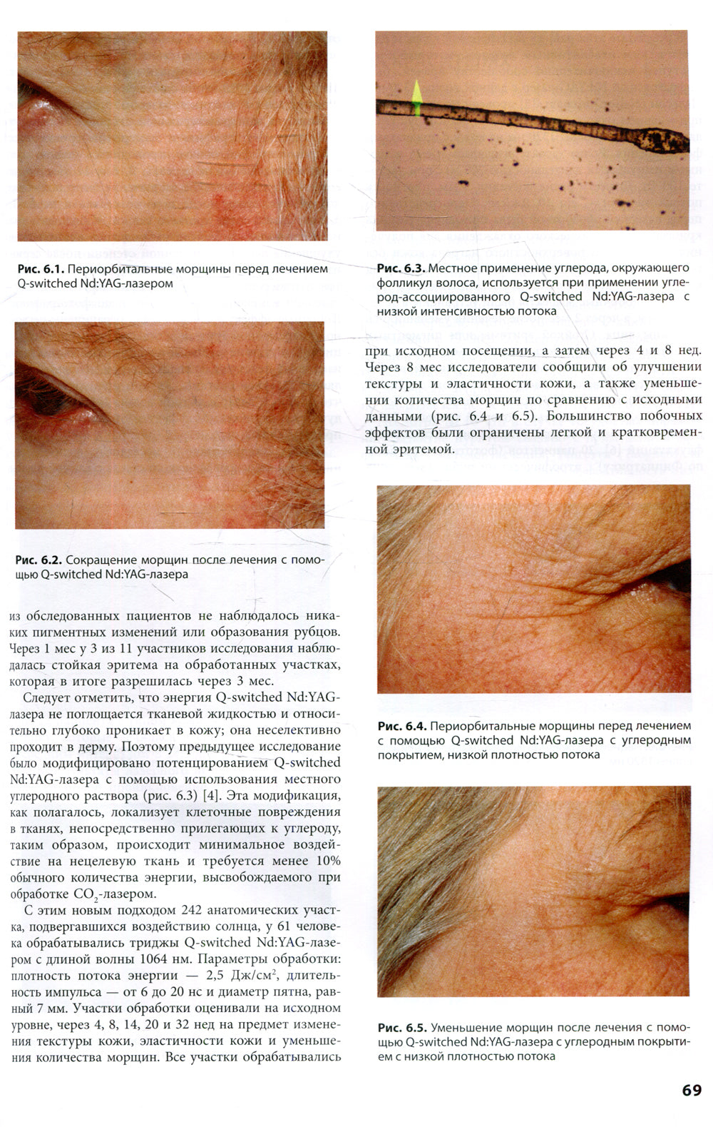 Процедуры в дерматологии. Клиническая косметология