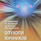 Опухоли яичников: руководство