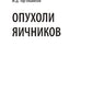 Опухоли яичников: руководство