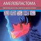 Амелобластома: современная диагностика, клиническая картина и лечение