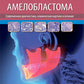 Амелобластома: современная диагностика, клиническая картина и лечение