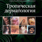 Тропическая дерматология