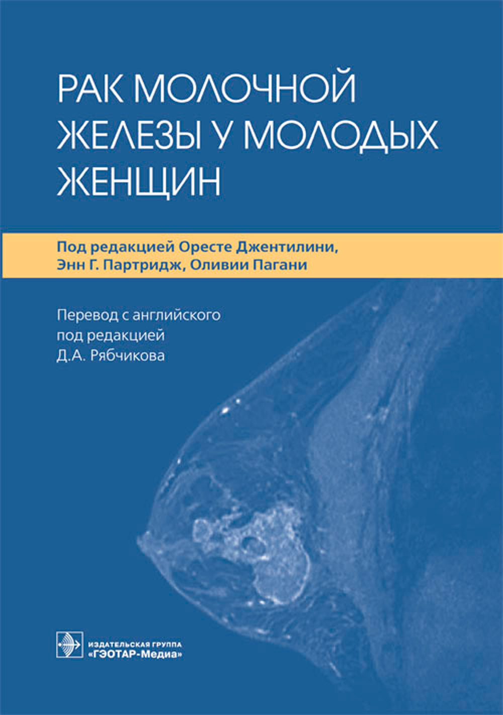 Рак молочной железы у молодых женщин