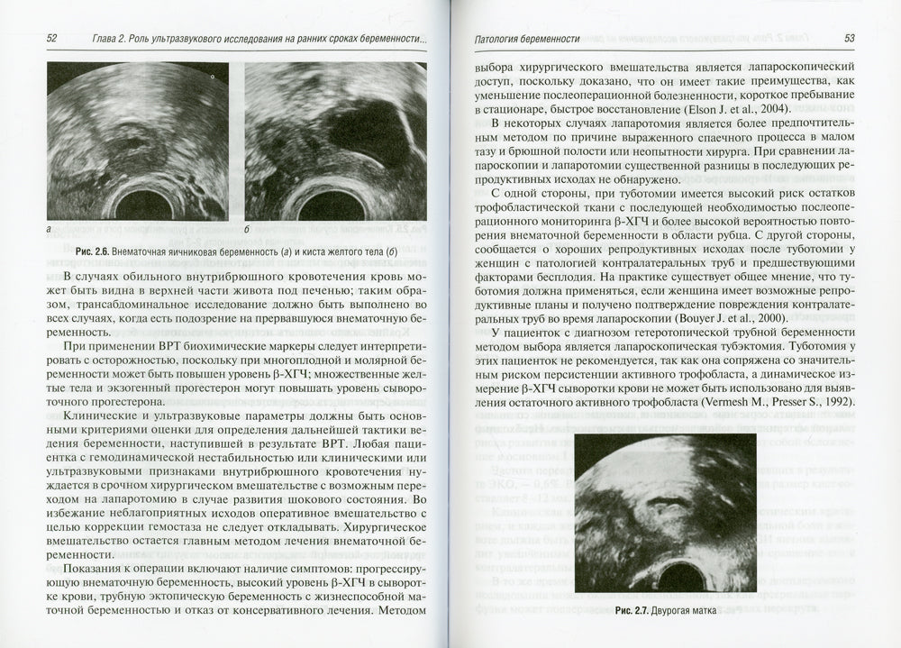 Ведение беременности ранних сроков, наступившей в результате протоколов ВРТ: руководство для врачей