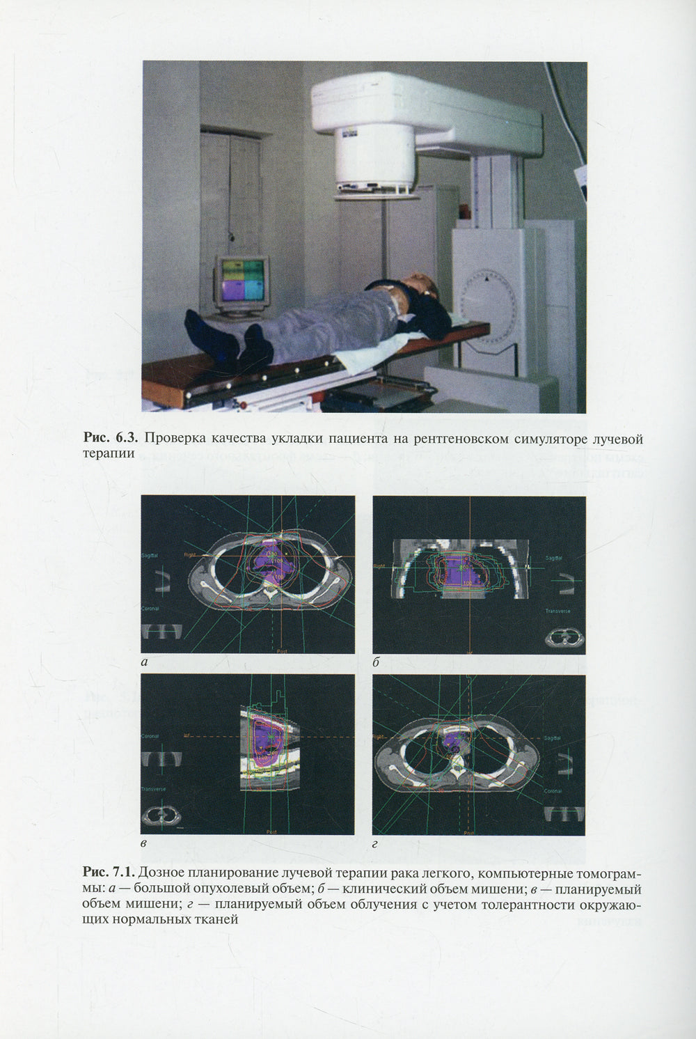 Лучевая терапия (радиотерапия): Учебник. 3-е изд., перераб. и доп