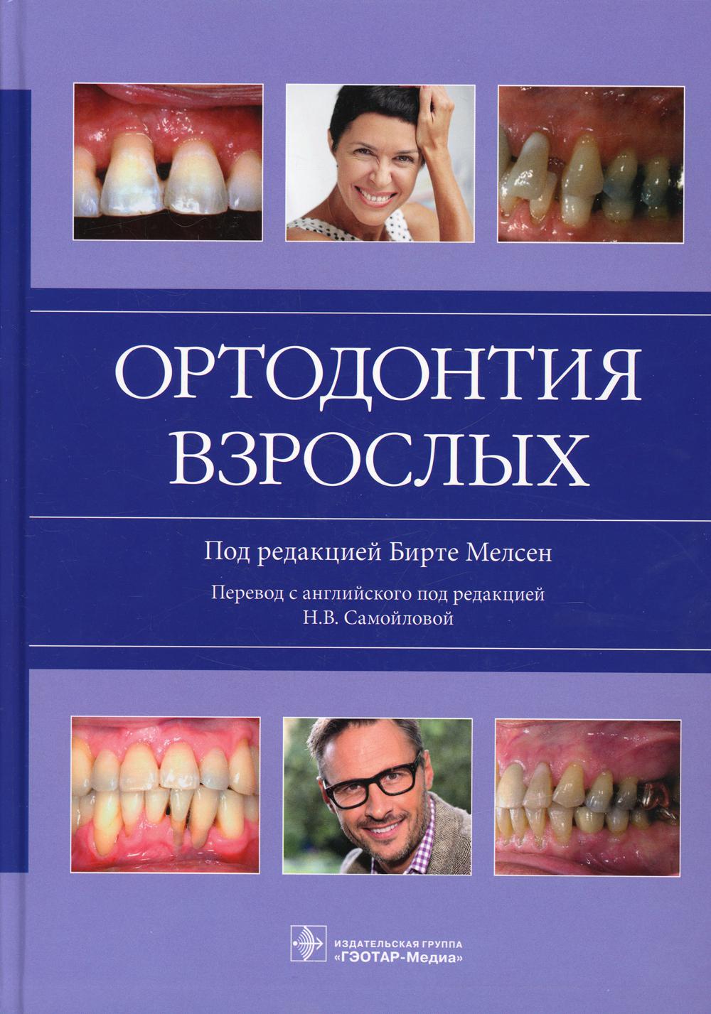 Ортодонтия взрослых