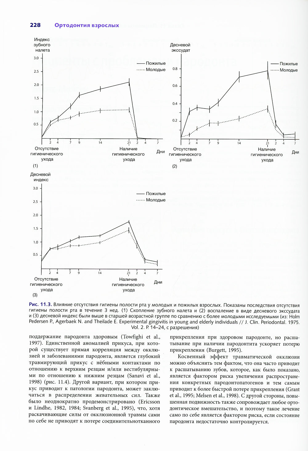 Ортодонтия взрослых