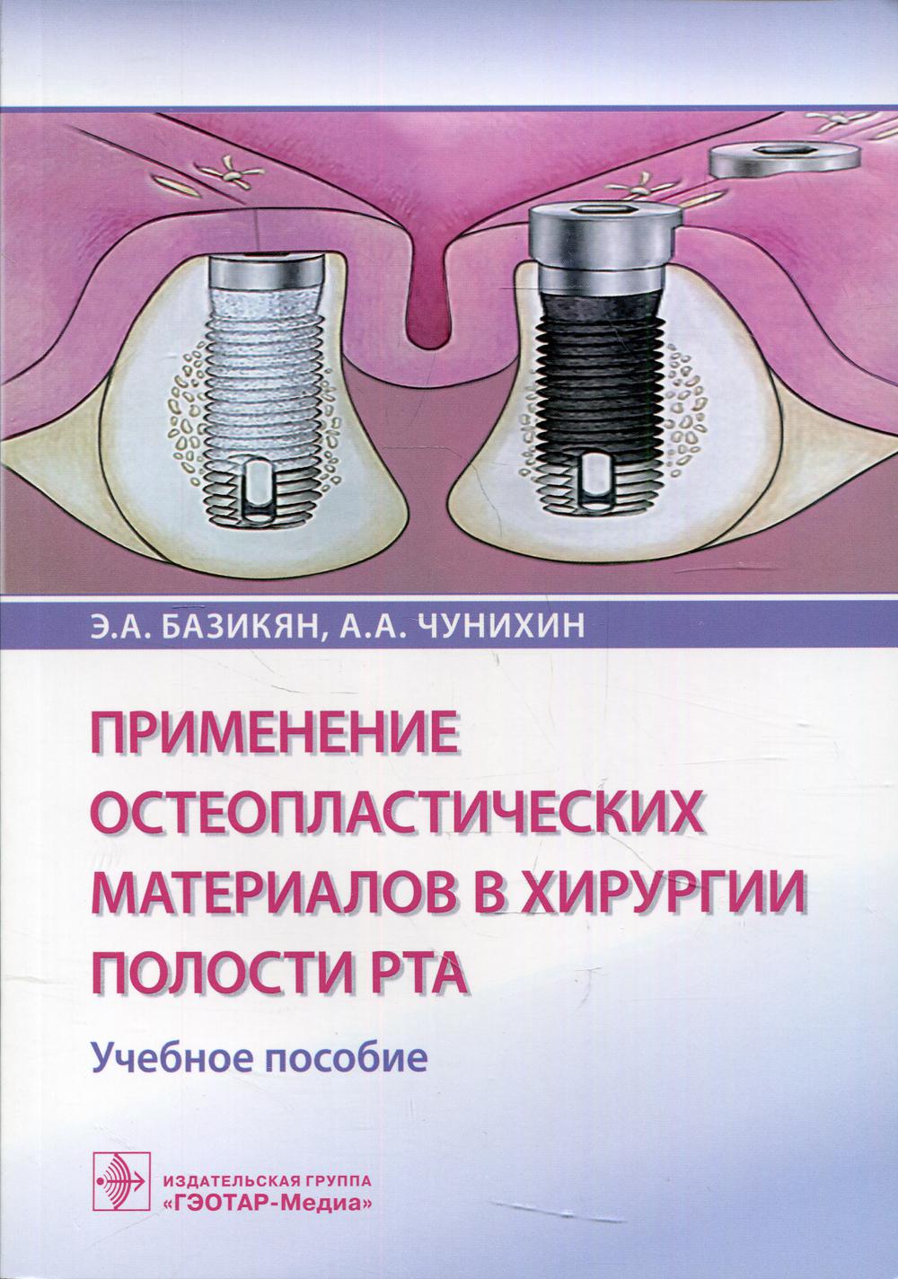 Présentation des matériaux ostéoplastiques dans la région de la haute couture :