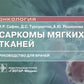 Саркомы мягких тканей: руководство для врачей