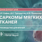 Саркомы мягких тканей: руководство для врачей