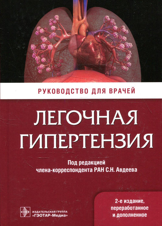 Легочная гипертензия: руководство для врачей. 2-е изд., перераб. и доп