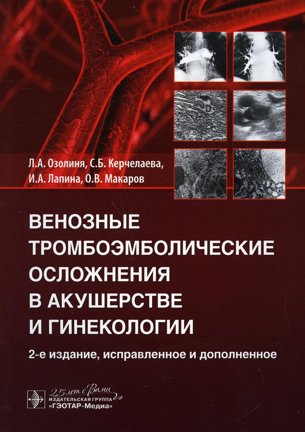 Венозные тромбоэмболические показатели в акушерстве и гинекологии. 2-е изд., испр. и доп