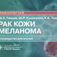 Рак кожа. Меланома: руководство для врачей