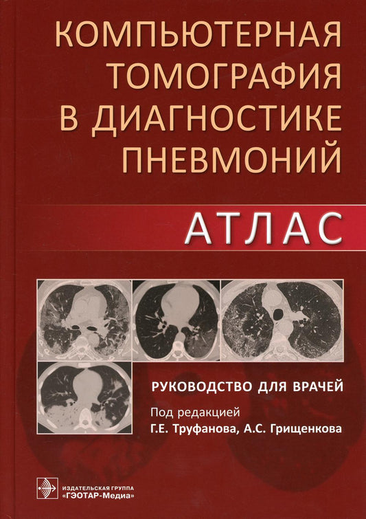 Компьютерная томография в диагностике пневмоний. Атлас: руководство для врачей