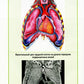 Клиническая анатомия сердца: иллюстрированный авторский цикл лекций