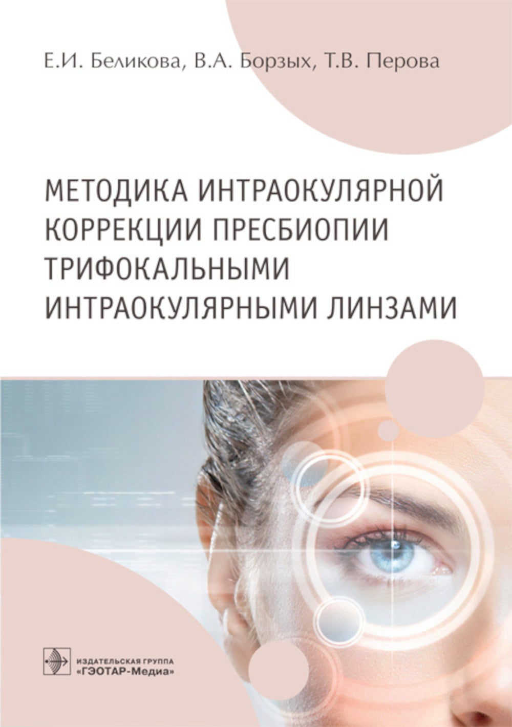 Méthode de correction intraoculaire de la pression trifocale pour les lignes intraoculaires : Il est préférable de le faire