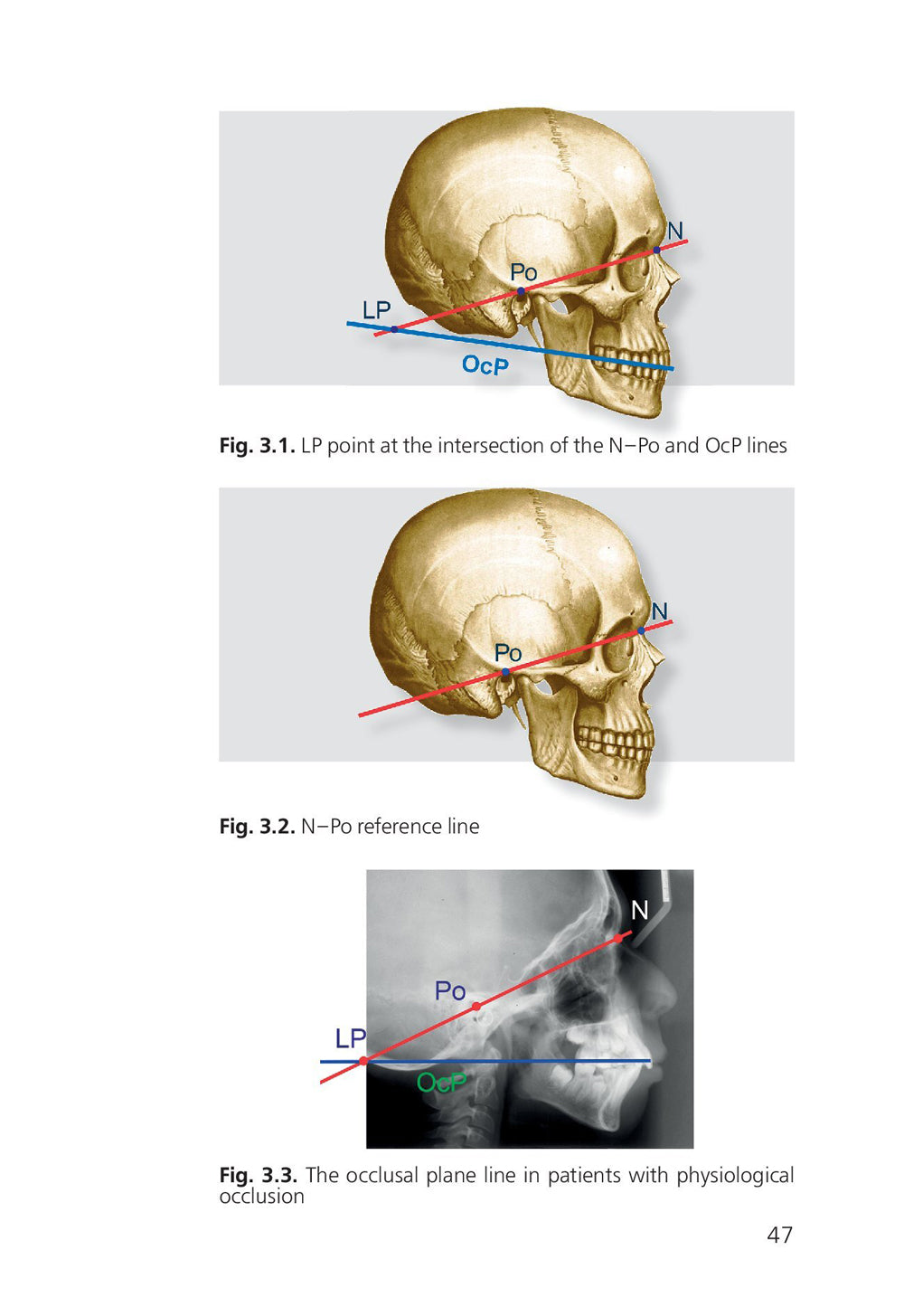 Orthodontie. Méthodes modernes de diagnostic des anomalies dentaires, de la dentition et de l'occlusion : tutoriel : sur l'angl.yaz