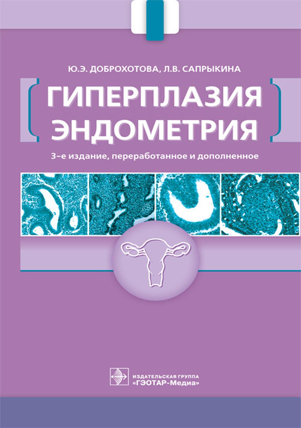 Гиперплазия эндометрия. 3-е изд., перераб. и доп