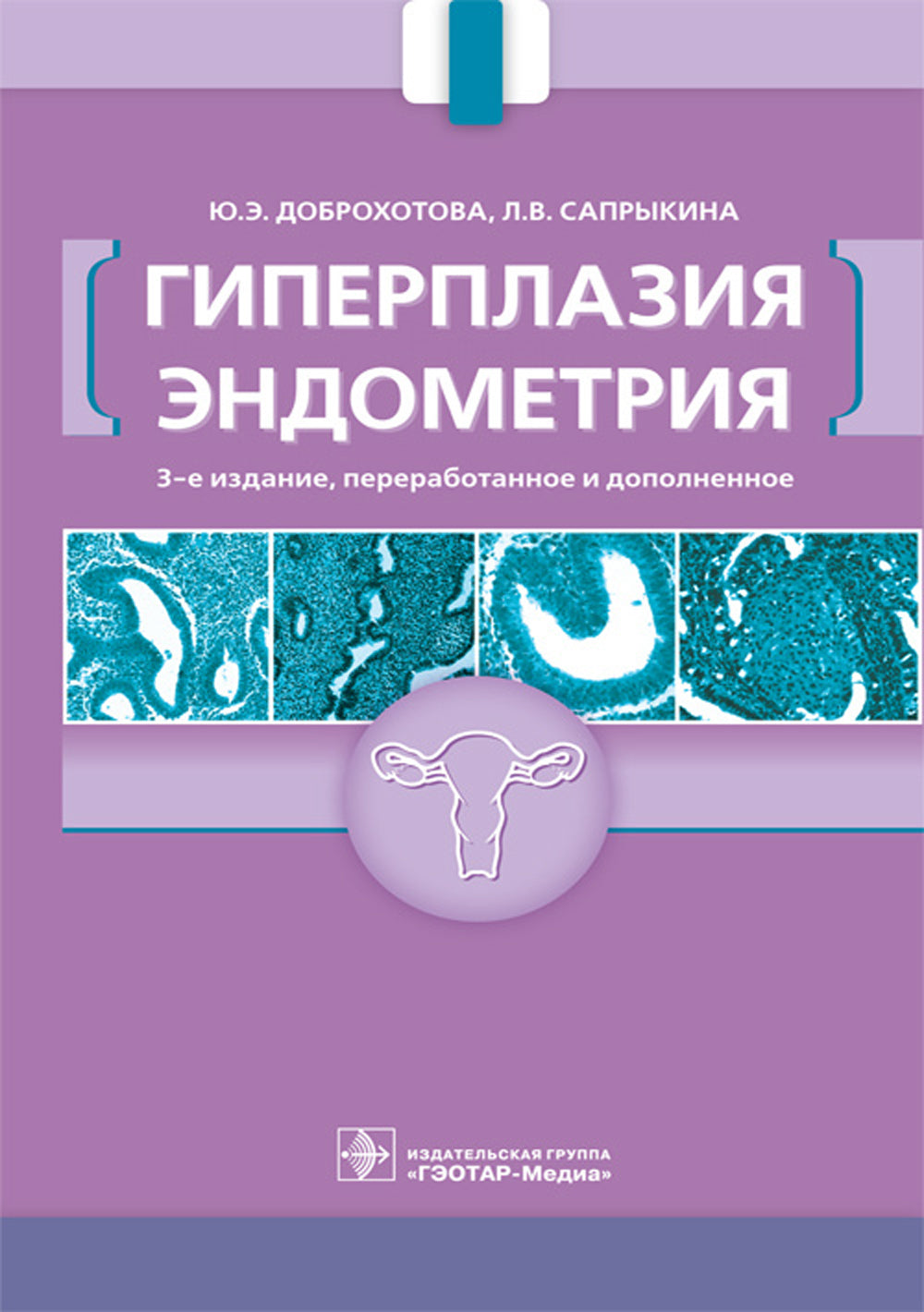 Гиперплазия эндометрия. 3-е изд., перераб. и доп