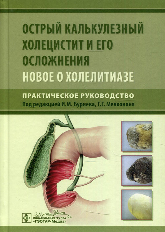 Острый калькулезный холецистит и его обследование. Новое о холелитиазе. Практическое руководство