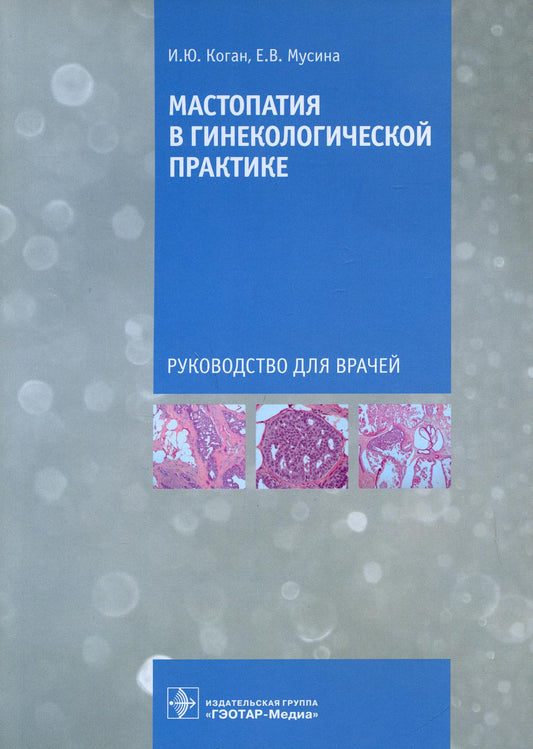 Мастопатия в гинекологической практике: руководство для врачей