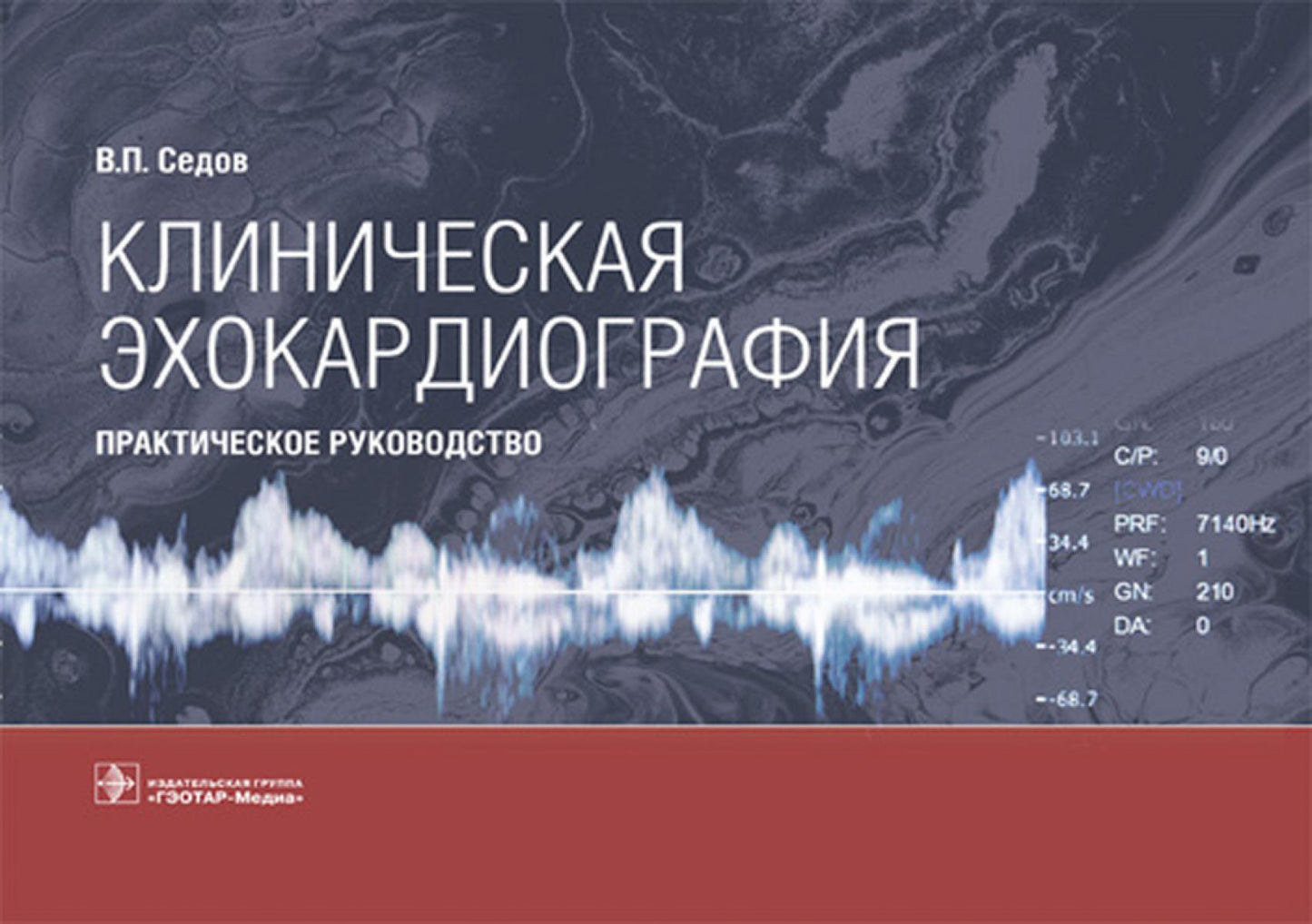 Клиническая эхокардиография: практическое руководство.