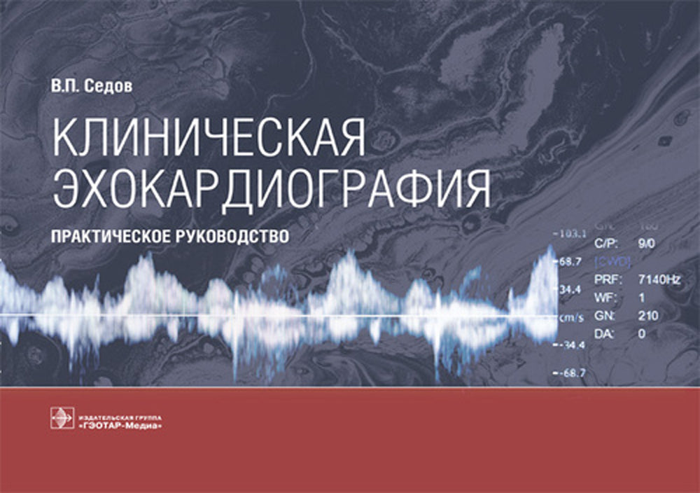 Клиническая эхокардиография: практическое руководство.