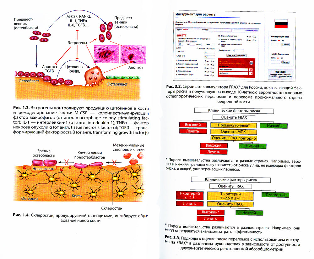Карманный справочник по остеопорозу